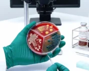 Staphylococcus-aureus